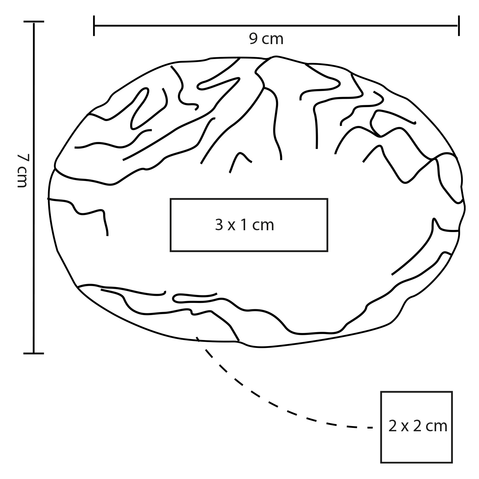 CEREBRO · Foto 3